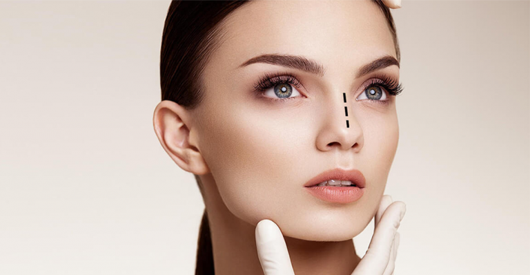 Rhinoplasty Procedure